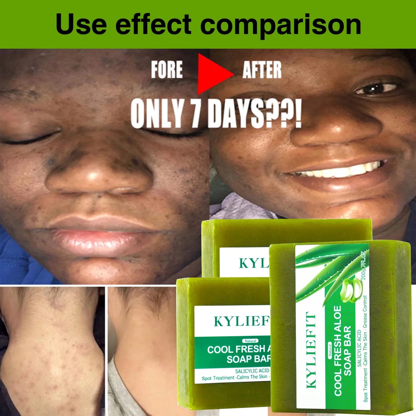 AILKE Aloe Vera Whitening Soap For Acne Radiant Skin All Skin Types Vegan